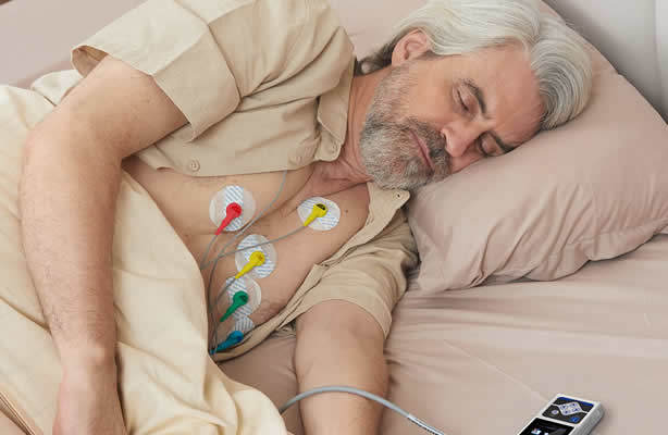 24hr ECG Holter Monitoring